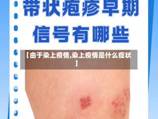 【由于染上疫情,染上疫情是什么症状】