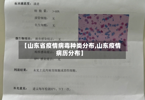 【山东省疫情病毒种类分布,山东疫情病历分布】-第1张图片