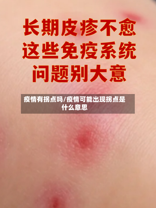 疫情有拐点吗/疫情可能出现拐点是什么意思-第1张图片