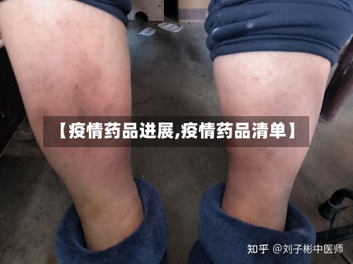 【疫情药品进展,疫情药品清单】-第2张图片