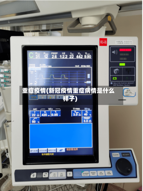 重症疫情(新冠疫情重症病情是什么样子)-第2张图片