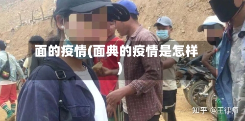 面的疫情(面典的疫情是怎样)-第2张图片