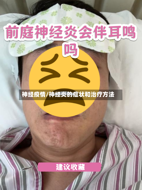 神经疫情/神经炎的症状和治疗方法-第2张图片